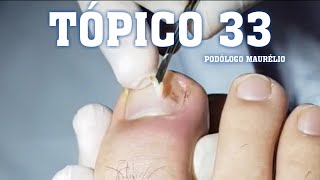 PARA OS AMANTES DAS UNHAS TÓPICO 33 (“For The Feet And Nail Lovers”)