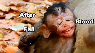 After Fall Baby Alba Has Slight Blood Out From Nose | Because Anna Careless Do Alba Live Danger Life