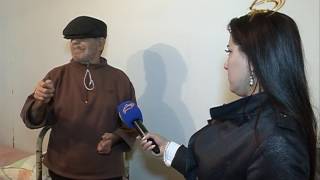 EN DEHSETLI DERI XESTELIYI - CUZAM