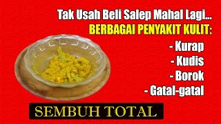 NGALAHIN OBAT DOKTER... BALURKAN RAMUAN INI, KADAS, KURAP, KUDIS, BOROK, GATAL-GATAL MENAHUN SEMBUH