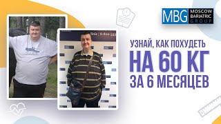 Минус 60 кг за 6 месяцев. Отзыв после уменьшения желудка (гастропластика)