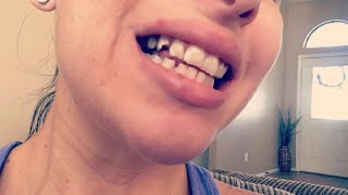 Drs. Investigate: Teenage Torture Camps?; Save My Twin’s Teeth!; Can Coffee Cause Weight Gain?