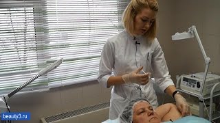 Решаем проблему повышенного потоотделения с помощью инъекций ботулотоксина