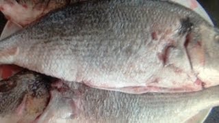 Моя беременность, Два Кесаревых сечения, Брекеты