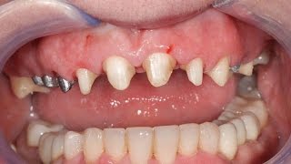 ЖАХОНДАГИ ЭНГ АНТИКА ВА КИЗИК СОЛИКЛАР  ТОП--7