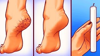 25 SIMPLE YET GENIUS BODY HACKS