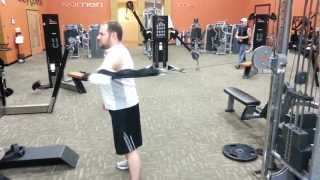 Congenital Amputee Left Arm Exercise