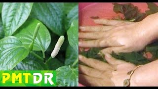 Cách Điều Trị Dứt Điểm Bệnh Ra Mồ Hôi Tay Chân Nhanh và Đơn Giản Bằng Loại Lá Lốt