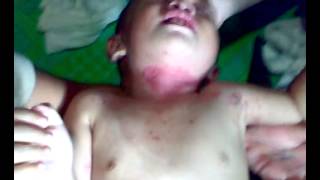 PEDIATRIC SKIN PROBLEMS