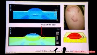 Dr Rei Ogawa: Mechanotherapy for a New Era in Medicine and Possibility of Hair Regenration