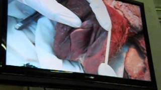 UG Female reproductive System 021
