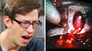 A Guy Watches His Own Surgery