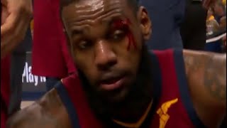 LeBron James BLEEDING near eye (Warning) Game 6 Cavs vs Pacers