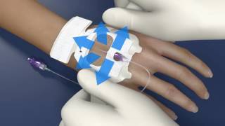 Tegaderm™ IV Advanced Dressing 1683 for PIV Application Video