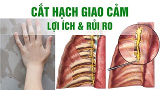 Cắt hạch thần kinh giao cảm là gì? Có nên cắt hạch giao cảm không?