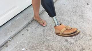Amputee Tips: How to wear flip flops as an amputee