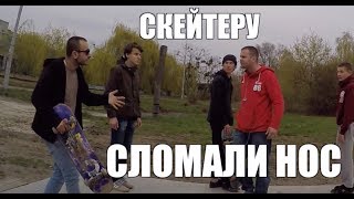 30-ти ЛЕТНЕМУ СКЕЙТЕРУ СЛОМАЛИ НОС !