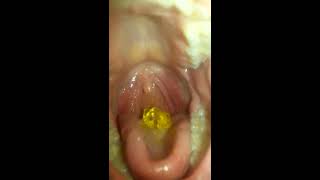 Mouthcam+Deep swallow...♡