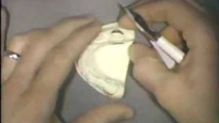 Technical Construction of Lingual Wire