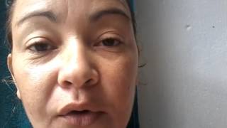 Vitacid acne gel, meu 1° vídeo,  tratamento contra acne, cicatrizes e manchas no rosto.