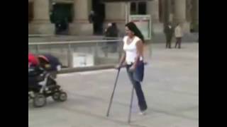 amputee, One Leg Woman