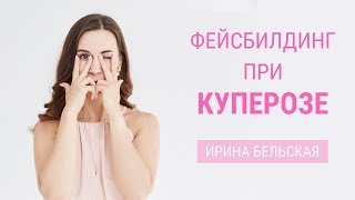 Купероз на лице. Стоит ли делать гимнастику для лица? | Школа фейсбилдинга Евгении Баглык