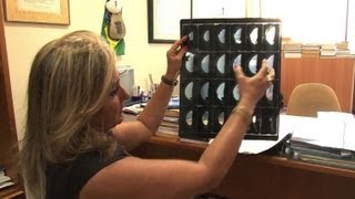 PIP managers go on trial in French implant scandal