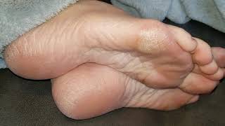tickling wife's dry feet