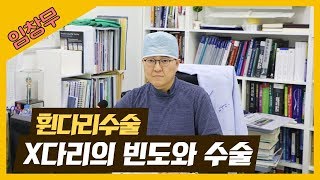 X자다리의 빈도와 수술적인 치료