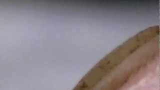 Vaginal Canal