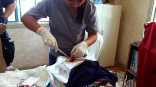 1st circumcision