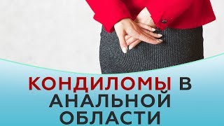 Кондиломы в анальной области
