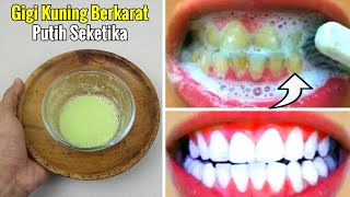 GIGI KUNING BAHKAN BERKARAT SEKALIPUN, LANGSUNG RONTOK SEJAK OLESAN PERTAMA