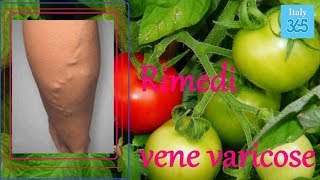 Come liberarsi delle vene varicose con 2 pomodori - Italy 365