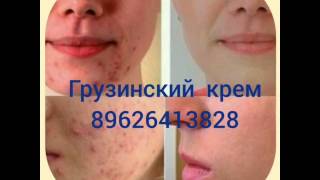 грузинский крем пилинг