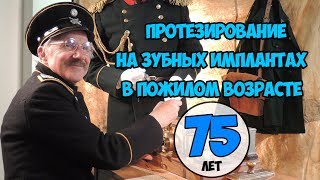 Протезирование на зубных имплантах в пожилом возрасте.