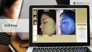 skin analyzer