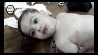 Слезы Сирии - Tears of Syria.