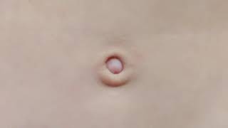 Belly button