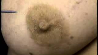 BREAST ANATOMY -  Breast Surgery - Collected By Dr.Sherif Saleh