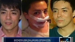 Saksi: Lance Raymundo, nag-iba ang itsura matapos operahan