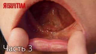 Я стесняюсь своего тела. Сезон 3. Выпуск 8. Часть 3 из 5