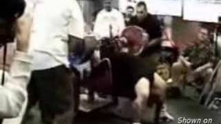 Bench Press Accident