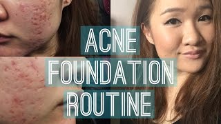 Drugstore Acne Coverage Foundation Routine | E.L.F Acne Fighting Foundation
