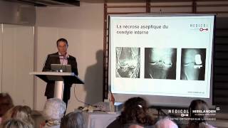 «La prothèse du genou dans tous ses états»  - Clinique Bois-Cerf