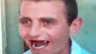 беззубый