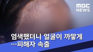 머리 염색했더니 얼굴이 까맣게…피해자 속출 (2019.01.16/뉴스데스크/MBC)