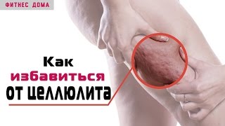 Как ИЗБАВИТЬСЯ от ЦЕЛЛЮЛИТА навсегда (Лучшие упражнения и советы как убрать целлюлит!!)