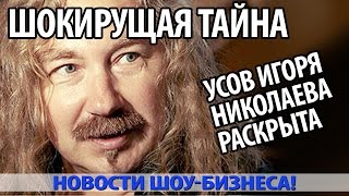 Шокирущая тайна усов ИГОРЯ НИКОЛАЕВА раскрыта