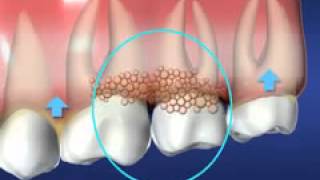 Periodontics